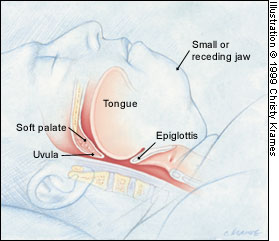 Figure 1B